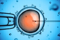 Інтрацитоплазматичне введення сперматозоїда (ICSI)