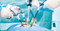 Advantages of laparoscopic surgery