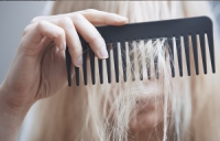 Hair loss in women: causes and help