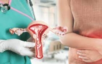 Total Hysterectomy: when is it performed and what to expect?