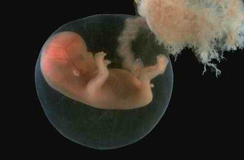 Эмбриональный период, фото