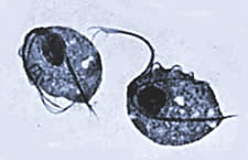 Trichomoniasis, фото