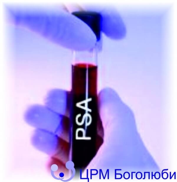 Prostatic specific antigen (PSA), фото