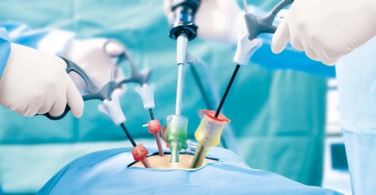 Advantages of laparoscopic surgery, фото