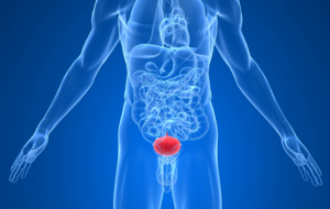 Tenesmus of the bladder: what are the causes and what to do?, фото