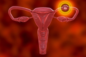 Ectopic pregnancy: signs and complications, фото