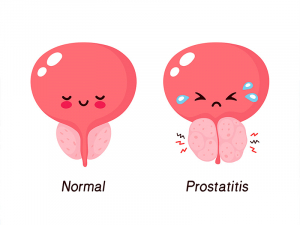 Visit to the urologist: chronic bacterial prostatitis, фото