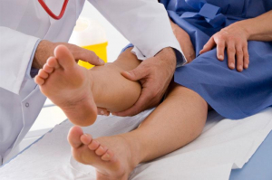 Phlebologist consultation: what causes swelling and pain in the legs?, фото