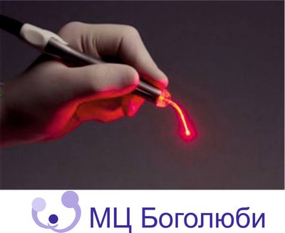 Ерозія шийки матки