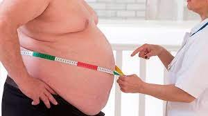 Bariatric surgery at the Bogolyuby Medical Center: gastric bypass for obesity