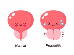Visit to the urologist: chronic bacterial prostatitis