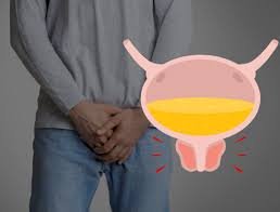Problems with urination: what is neurogenic bladder?